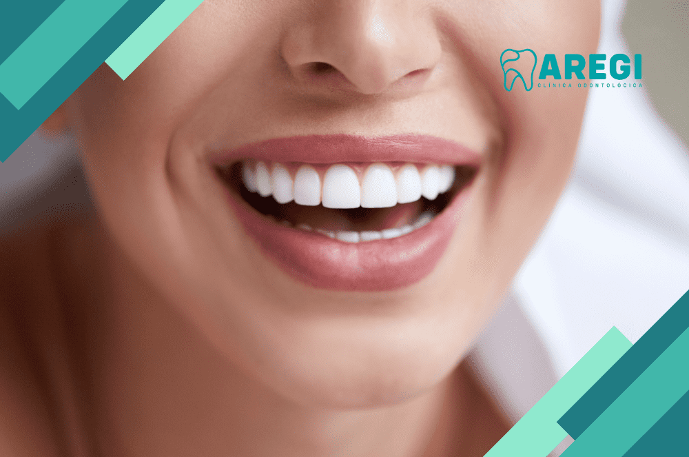 Os Benefícios do Clareamento Dental: Um Sorriso Mais Brilhante